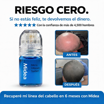 El sistema de microinfusión para el crecimiento del cabello